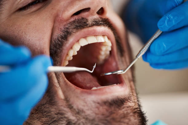 Best Emergency TMJ Treatment in Moriches, NY
