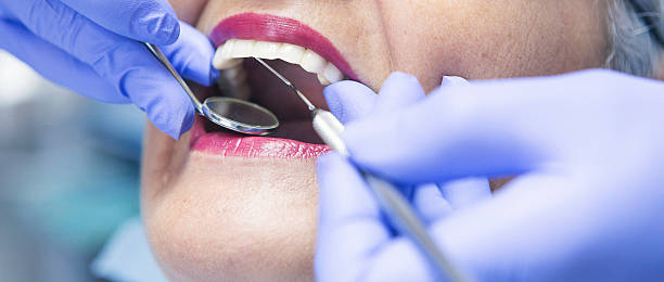 Best Emergency Tooth Extraction in Moriches, NY